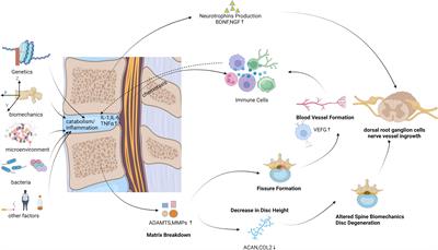 From drugs to biomaterials: a review of emerging therapeutic strategies for intervertebral disc inflammation